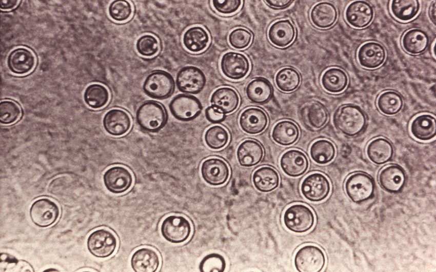 Blastomyces dermatitidis Onmeda.de