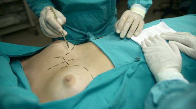 Man sieht die Brüste einer Frau und einen Chirurgen während einer Schönheits-OP (Brustvergrößerung).
