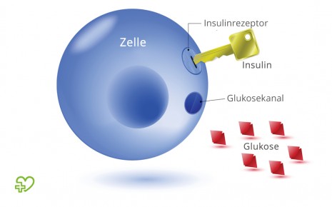 Diabetes mellitus: Grafische Darstellung der Glukoseaufnahme und der Bedeutung von Insulin.