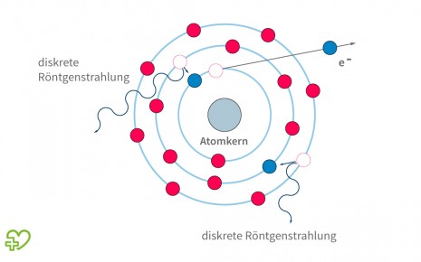 Grafische Darstellung: Diskrete Röntgenstrahlung