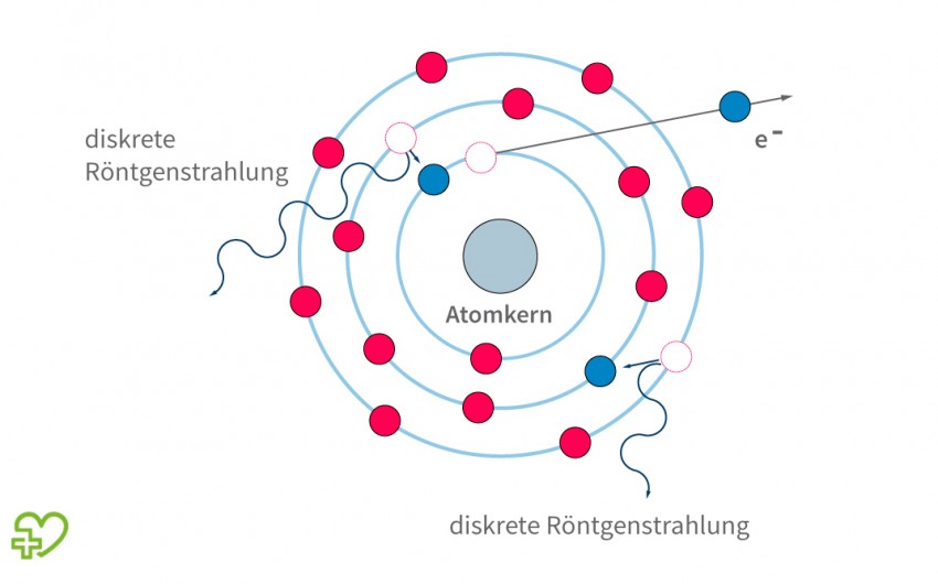 Grafische Darstellung: Diskrete Röntgenstrahlung