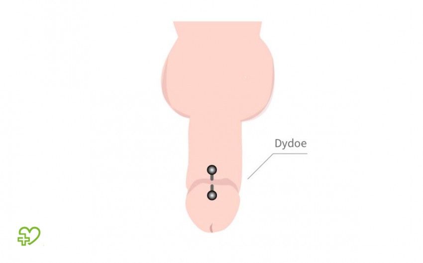 Piercing dydoe Penis Piercing: