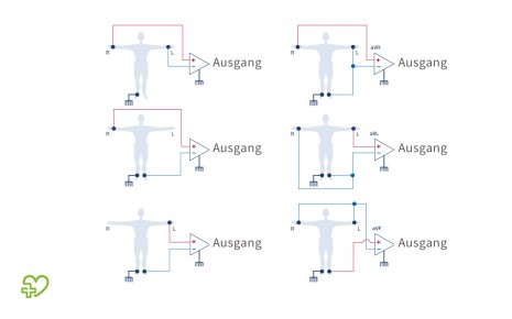 Die drei Ableitungen nach Einthoven (links) und nach Goldberger (rechts).