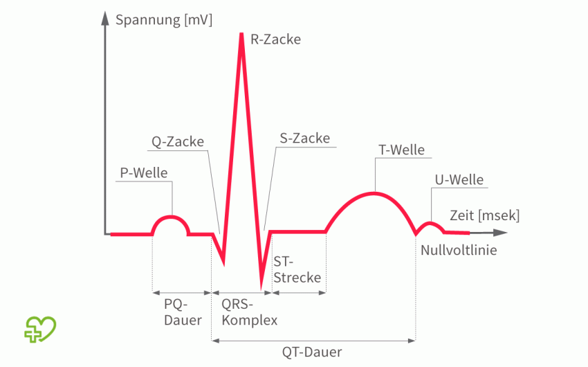 Illustration: Auswertung eines EKGs