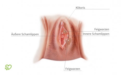 Knötchen scheide kleine Knötchen an