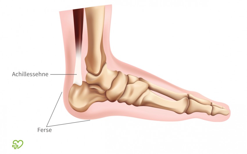 Fersenschmerzen: Man sieht eine anatomische Darstellung des Fußes.