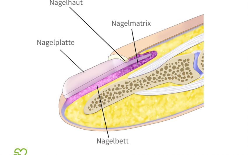 Wird schwarz fußnagel Nagelerkrankungen: Es