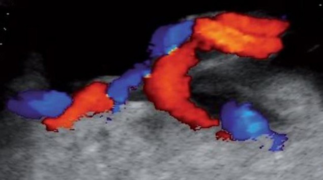 Entwicklung Embryo / Fötus / Baby - Onmeda.de
