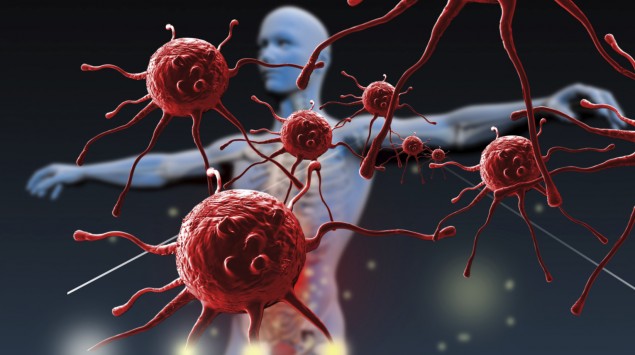 Was Ist Hiv Für Eine Krankheit AIDS und HIV-Infektion: Symptome, HIV-Übertragung, Therapie - Onmeda.de