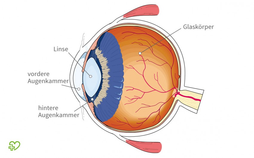 Eine grafische Darstellung des Innenraums des Auges. Gekennzeichnet sind die beiden Augenkammern, die Linse sowie der Glaskörper.