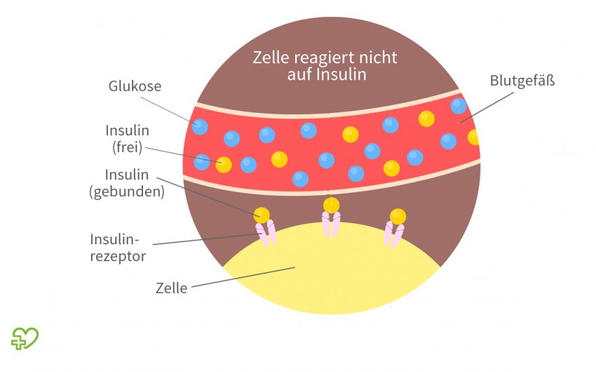 diabetes mellitus definition deutsch)