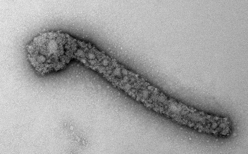 Marburg-Virus-Infektion: Man sieht eine elektronenmikroskopische Aufnahme des Lake Victoria Marburg-Virus.