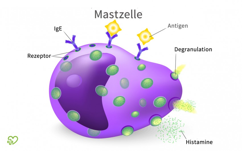 Wenn IgE-Antikörper an entsprechende Rezeptoren auf den Mastzellen binden und passende Antigene an die IgE-Antikörper andocken, setzt die Mastzelle Histamin und andere Botenstoffe frei.