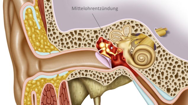 Ohrenschmerzen: Ursachen, Behandlung, Hausmittel - Onmeda.de