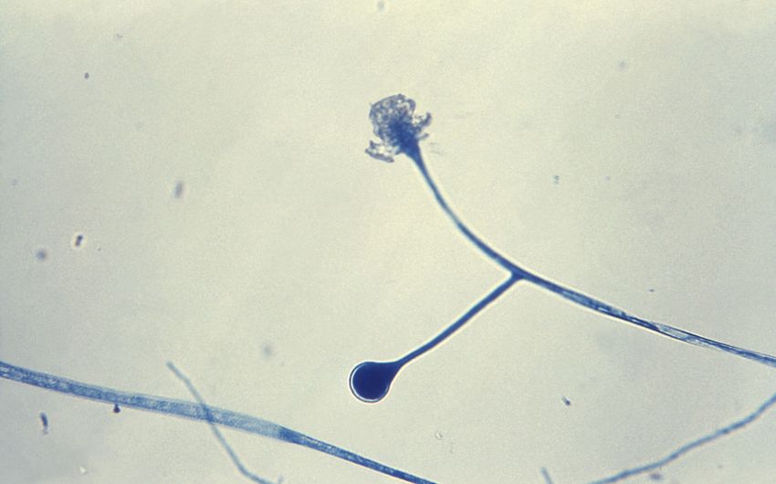 Man sieht eine mikroskopische Aufnahme von Sporangien der Schimmelpilz-Gattung Mucor.