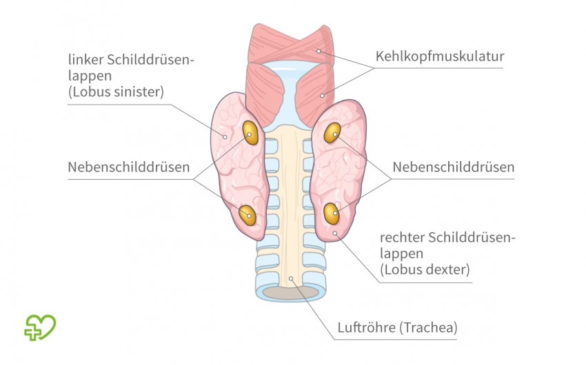 Grafische Darstellung der Nebenschilddrüsen.