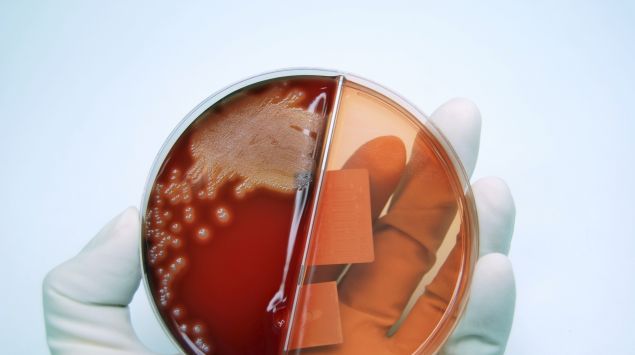 Das Bild zeigt eine Petrischale mit Pneumokokken.