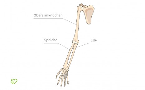 Abbildung der Armknochen (Oberarmknochen, Unterarmknochen, Hand-Skelett