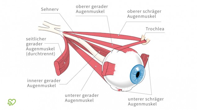 Röntgen - Onmeda.de