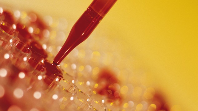 Das Bild zeigt eine Pipette gefüllt mit Blut.