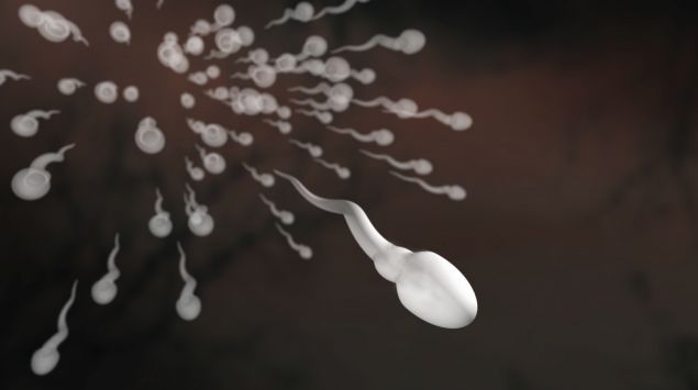 Das Bild zeigt Spermien.
