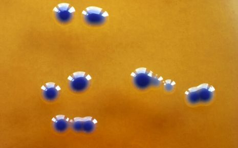 Blaugefärbte E.-coli-Kolonien.