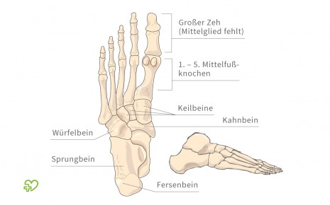 Abbildung des Fuß-Skeletts