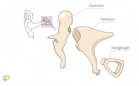 Abilldung der einzelnen Gehörknochen: Hammer, Amboss und Steigbügel