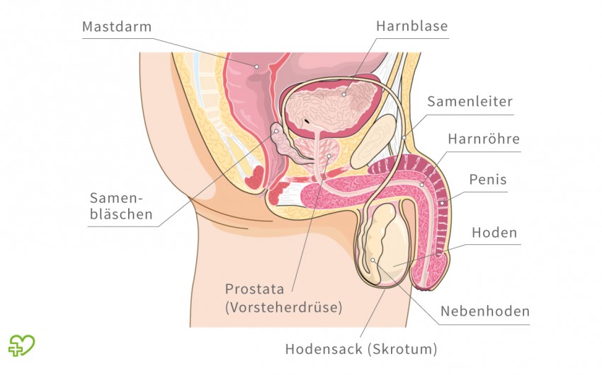 prostatakarzinom symptome