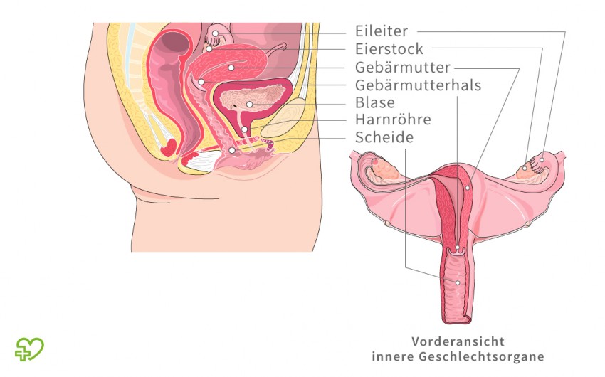 Gebärmutterentfernung nach wie krankenhaus lange Gebärmutterentfernung (Hysterektomie)