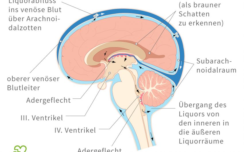 Man sieht eine schematische Darstellung des Gehirns und dem Liquorfluss.