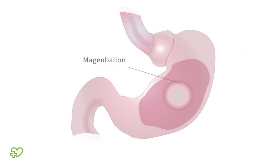 Illustration: Magenballon.