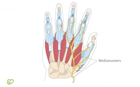 Mittelarmnerv (Nervus medianus) in der Hand