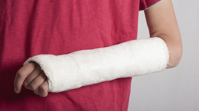 Das Bild zeigt einen gebrochenen Arm.