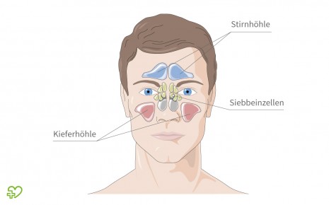Man sieht eine Illustration, die die Lage der Nasennebenhöhlen zeigt.