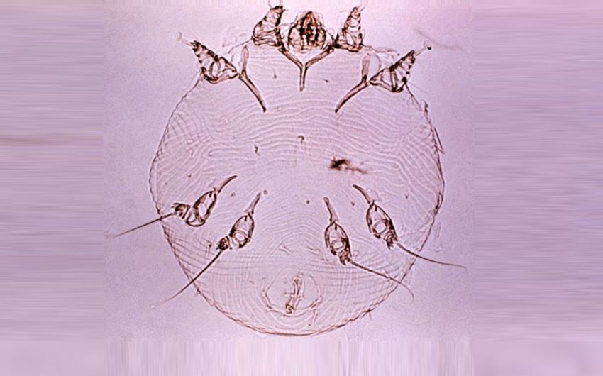 Aufnahme der Krätzmilbe Sarcoptes scabiei unter dem Mikroskop