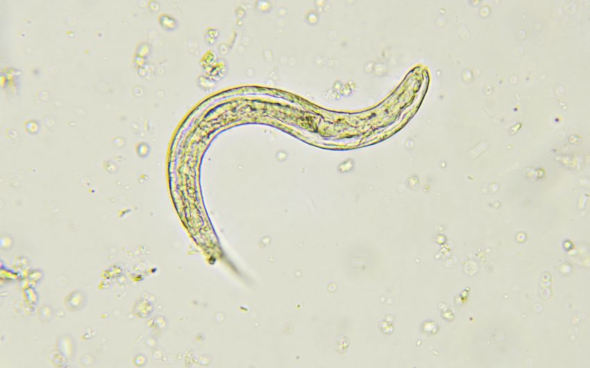 Man sieht eine Aufnahme einer Larve des Zwergfadenwurms (Strongyloides stercoralis).