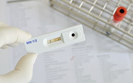 Man sieht einen HIV-Test.